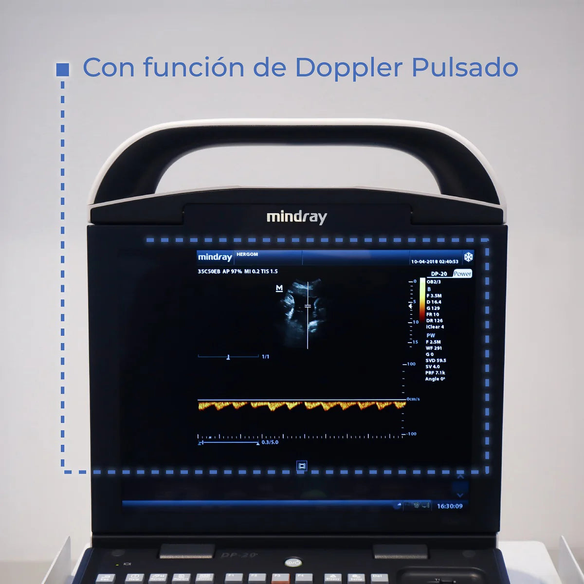 Ultrasonido Portátil para Uso Humano DP20 con función Doppler Pulsado y mejoradores de imagen iBeam y iClear - Marca Mindray