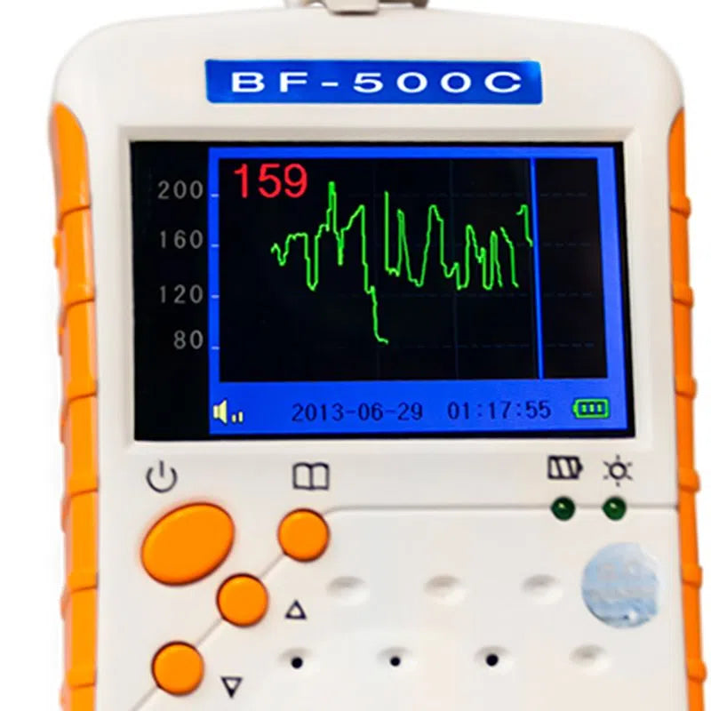 DOPPLER DE BOLSILLO CON PANTALLA 2 MHZ | MARCA BETSMAN