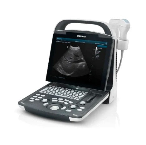 Ultrasonido Portátil para Uso Humano DP20 con función Doppler Pulsado y mejoradores de imagen iBeam y iClear - Marca Mindray