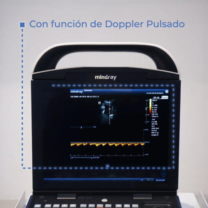 Ultrasonido Portátil para Uso Humano DP20 con función Doppler Pulsado y mejoradores de imagen iBeam y iClear - Marca Mindray