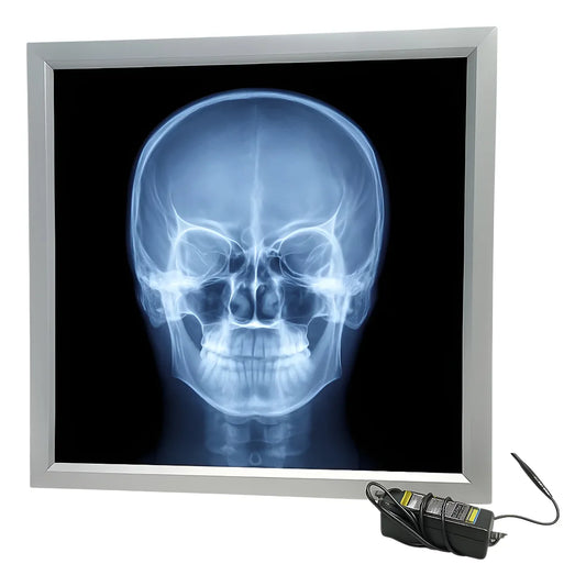 Negatoscopio Led Médico Caja Luz Radiografías Y Rx